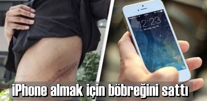 iPhone almak için böbreğini satan genç yatalak kaldı!