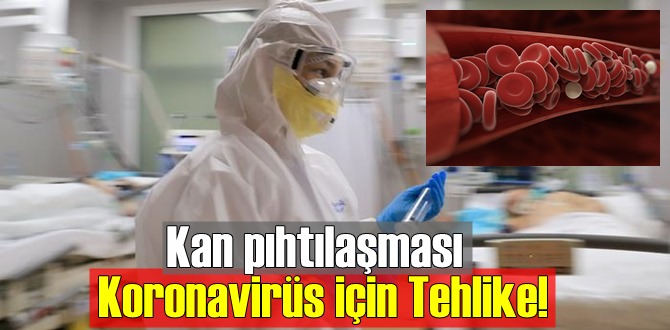 Kan pıhtılaşması Koronavirüs için büyük Tehlike arz ediyor!