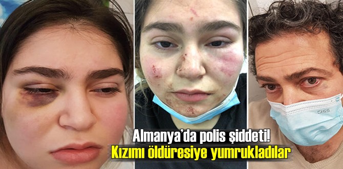 Almanya’da polis şiddeti! Kızımı öldüresiye yumrukladılar